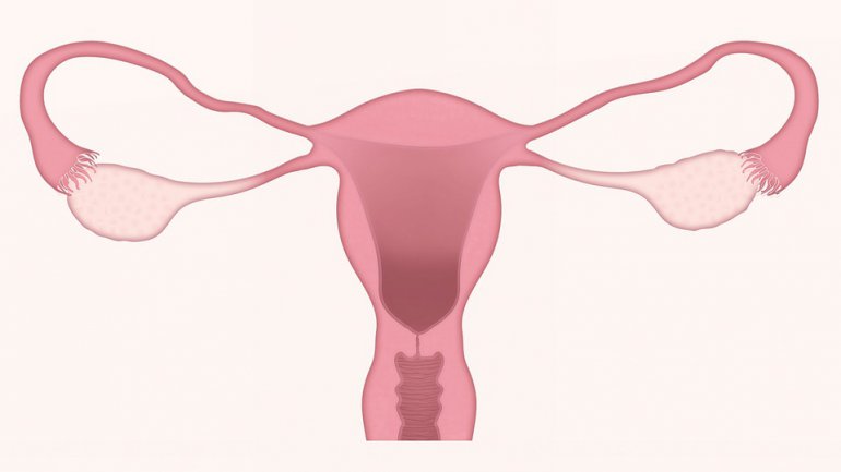 zioła na endometriozę